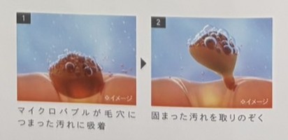 マイクロバブルが毛穴につまった汚れを取りのぞく説明図