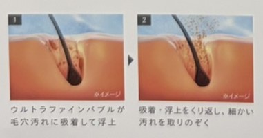 ウルトラファインバブルが毛穴汚れに吸着して浮上する説明図